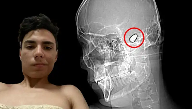 Kafasında Patlayıcı Var Gibi Yaşamak: Zihinsel Sağlık Sorunu