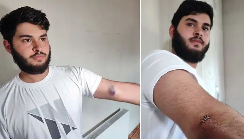 Bahçeye Kaçan Top, Mahallede Gergin Anlara Neden Oldu