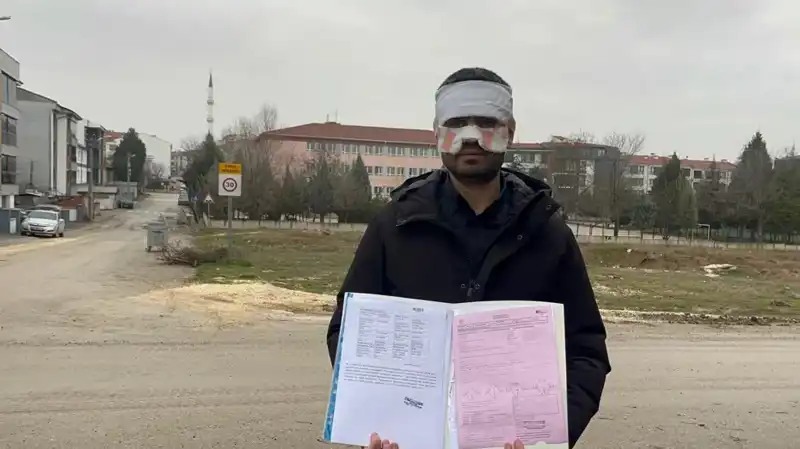 Öğretmenler Arasında Şok Eden Olay: Yüzüne Sıcak Çay Fırlatıldı!