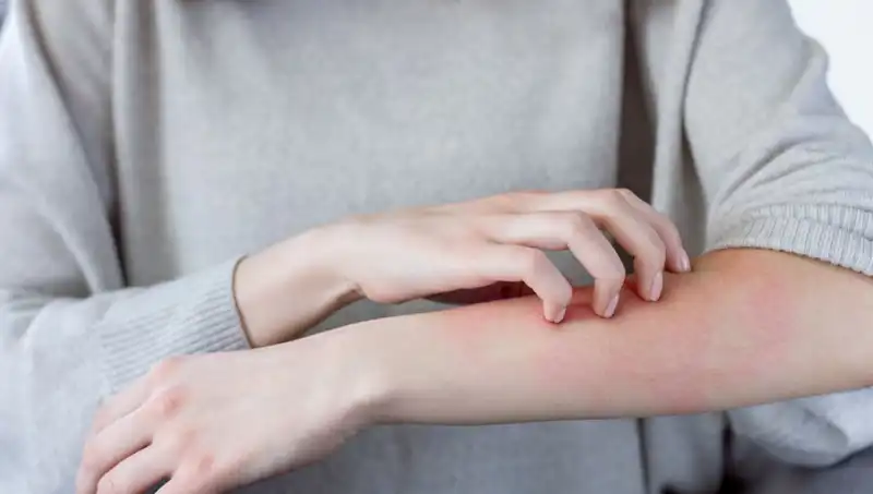 Cilt Kanseri Tehlikesi: Dermatologdan Şaşırtan İpuçları